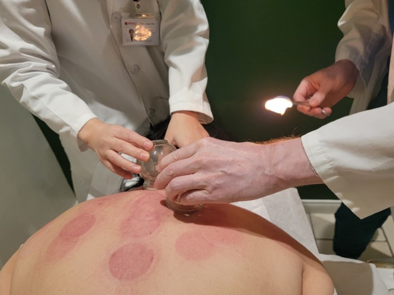 Cupping therapy at Wongu Health Center